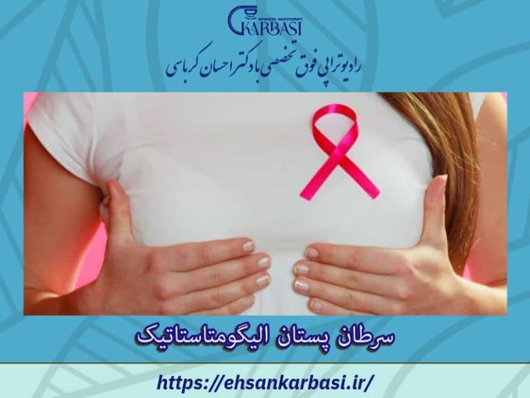 سرطان سینه الیگومتاستاتیک 2 پرتو درمانی سرطان سینه الیگومتاستاتیک