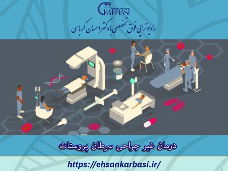 درمان غیر جراحی سرطان پروستات 2 درمان غیر جراحی سرطان پروستات