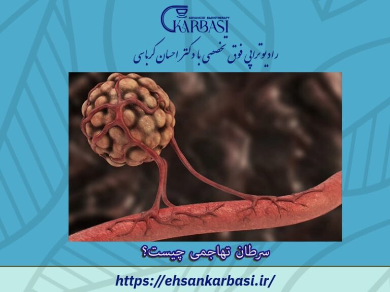سرطان تهاجمی چیست؟ 4 نوع سرطان تهاجمی شایع 2 سرطان تهاجمی چیست؟