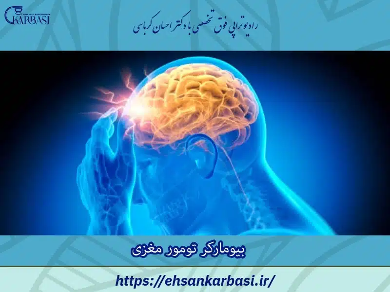 بیومارکر تومور مغزی