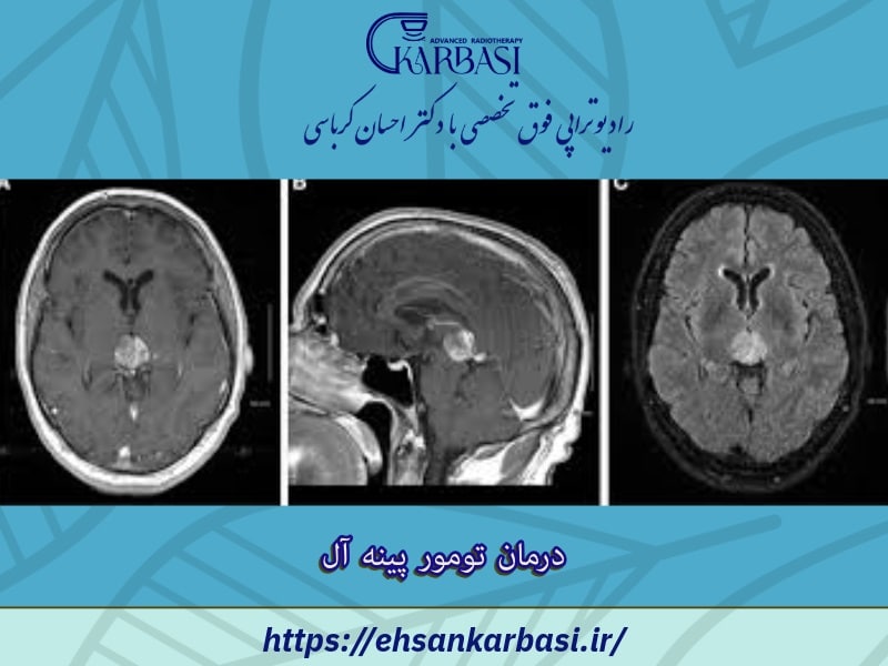 درمان تومور پینه آل