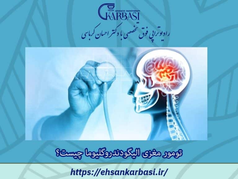 آنچه باید در مورد تومور مغزی الیگودندروگلیوما بدانید 2 تومور مغزی الیگودندروگلیوما