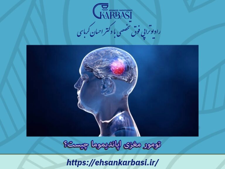 آنچه باید در مورد تومور مغزی اپاندیموما بدانید 2 تومور مغزی اپاندیموما