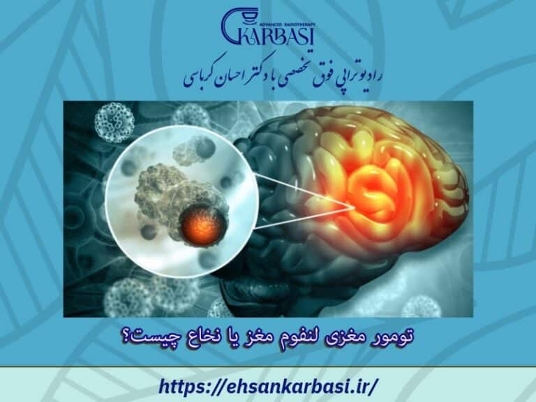 تومور مغزی لنفوم مغز یا نخاع چیست؟ 2 تومور مغزی لنفوم مغز یا نخاع چیست؟