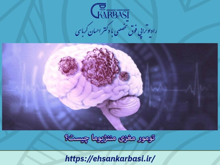 تومور مغزی مننژیوما چیست؟ 2 تومور مغزی مننژیوما چیست؟
