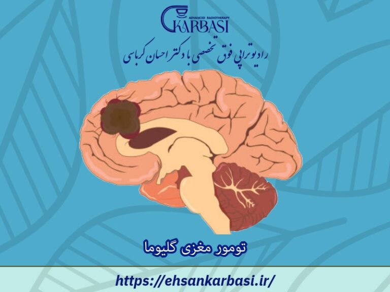 تومور مغزی گلیوما: علائم، انواع و راههای درمان 2 تومور مغزی گلیوما