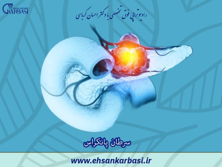 سرطان پانکراس: علائم، علل، تشخیص و درمان 2 سرطان پانکراس