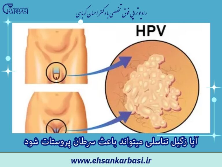آیا زگیل تناسلی میتواند باعث سرطان پروستات شود