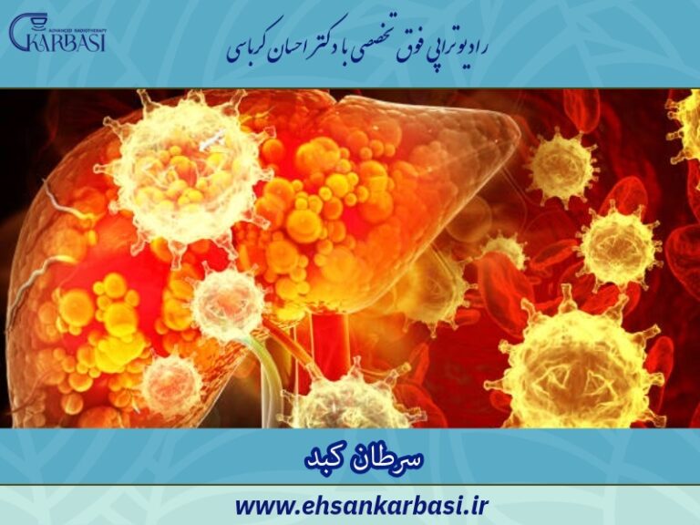 سرطان کبد چیست؟ علائم، علل و جدیدترین روشهای درمان 2 سرطان کبد