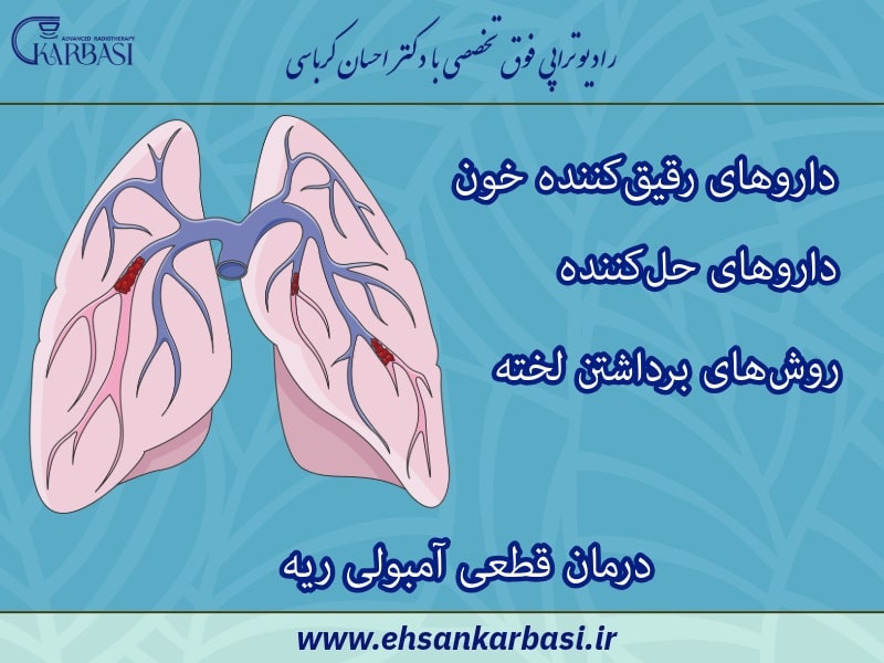 درمان قطعی آمبولی ریه