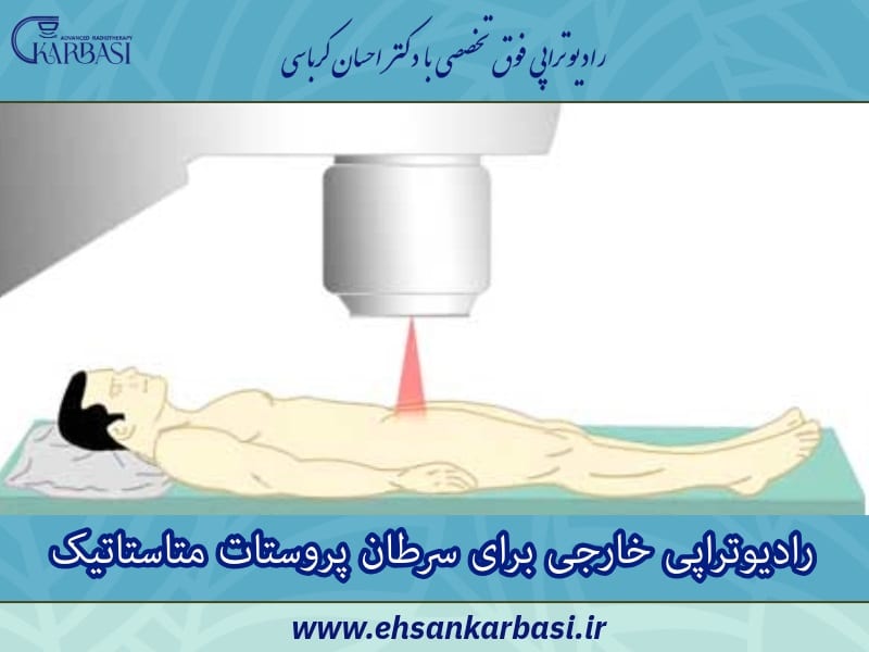پرتو درمانی خارجی سرطان پروستات متاستاتیک 3 رادیوتراپی خارجی برای سرطان پروستات متاستاتیک