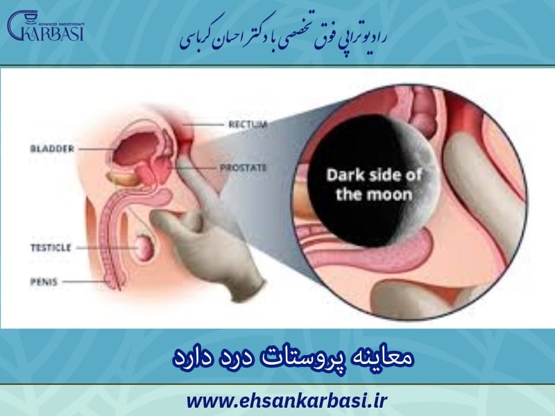 آزمایش های پروستات چیست؟ آشنایی با ۵ تست مهم غده پروستات 4 معاینه پروستات درد دارد