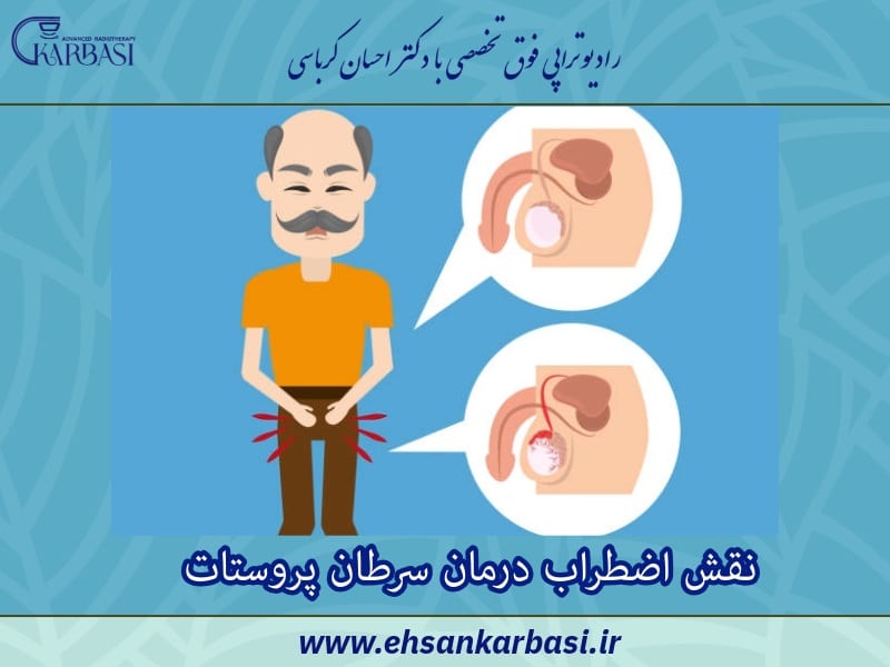 نقش اضطراب درمان سرطان پروستات