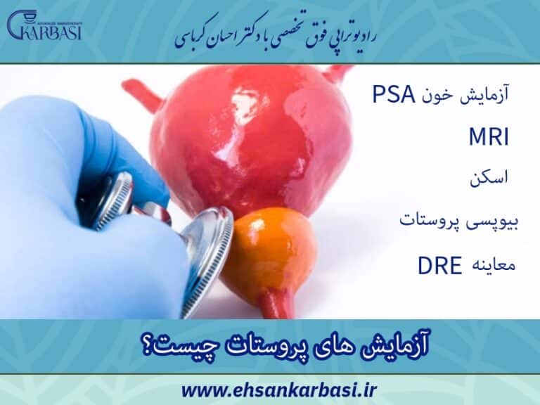 آزمایش های پروستات چیست؟ آشنایی با ۵ تست مهم غده پروستات 2 آزمایش های پروستات چیست؟