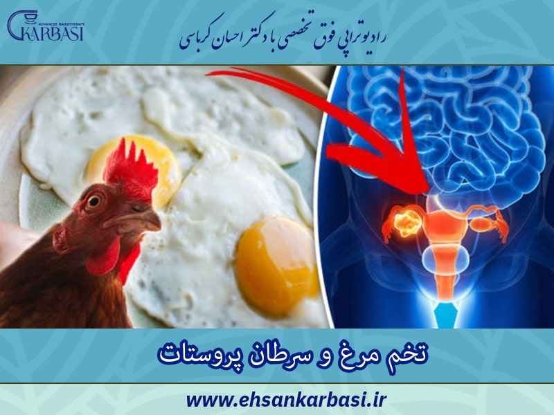 تخم مرغ و سرطان پروستات