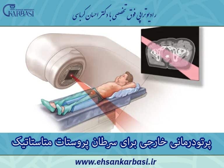 پرتو درمانی خارجی سرطان پروستات متاستاتیک 2 پرتو درمانی خارجی سرطان پروستات متاستاتیک