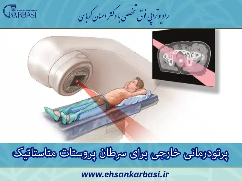 پرتو درمانی خارجی سرطان پروستات متاستاتیک